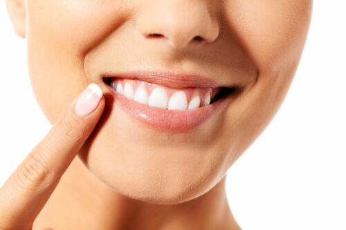 Photo of Whitening